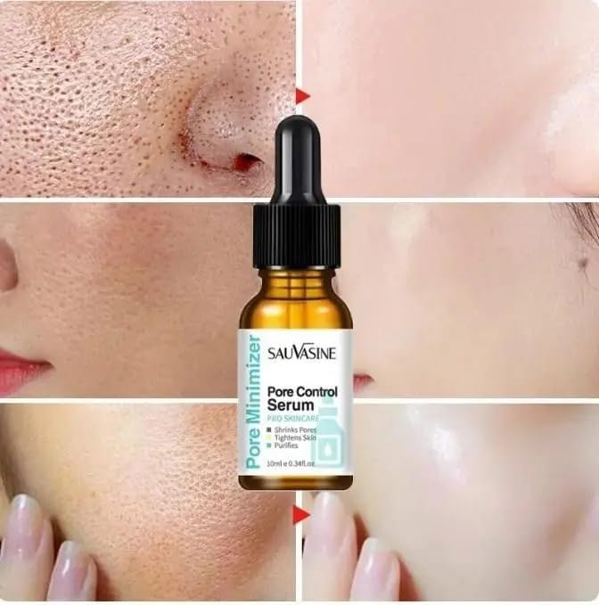 Pore Minimizer Serum for Acne and Dark Spots
